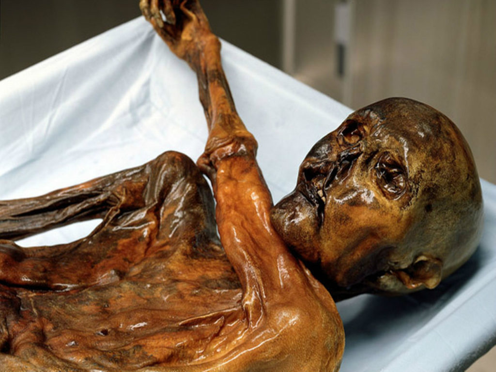 The Curse Of Otzi, The Murdered Ice Man